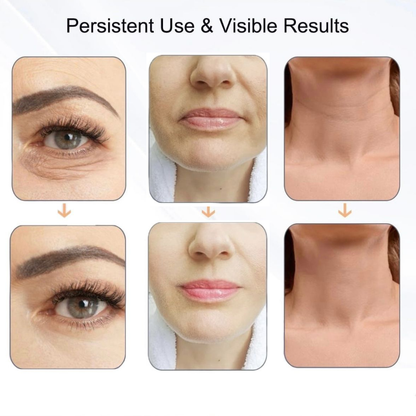 Neck & Face Wrinkle Remover